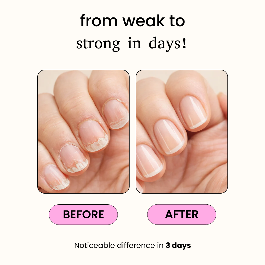 3-Day Keratin Nail Repair Oil